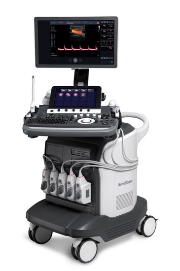 Sonoscape S50 Elite